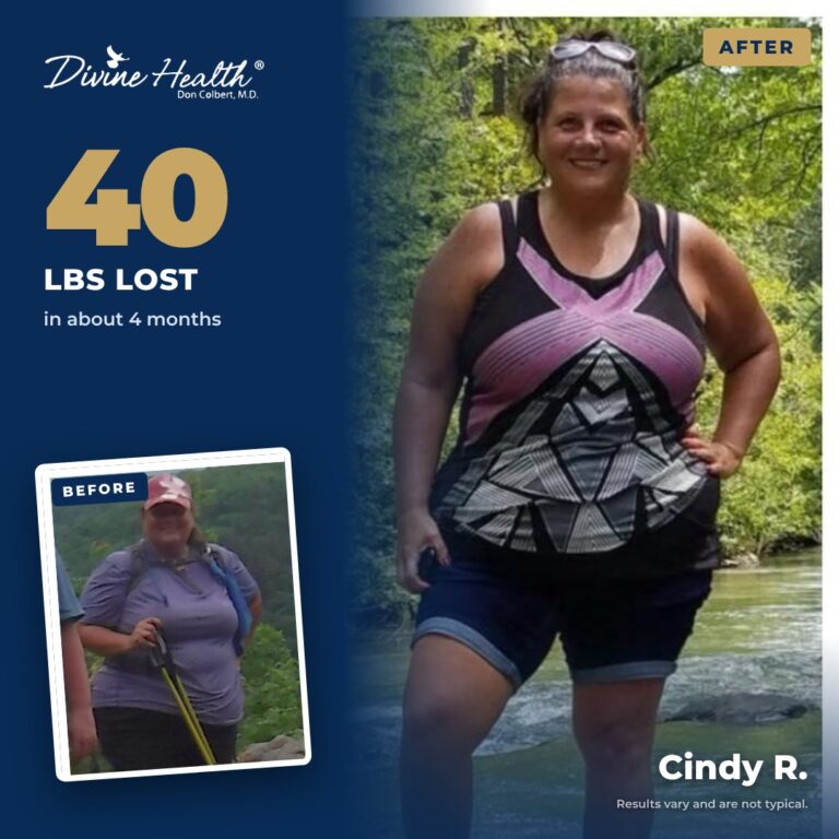 Cindy R. before and after