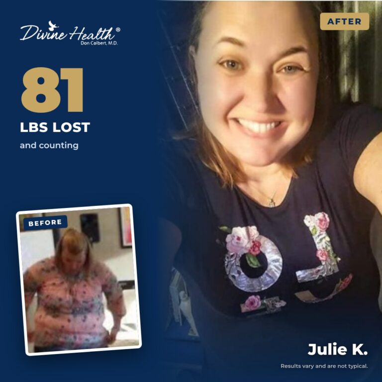 Julie K. before and after, 81 lbs and counting