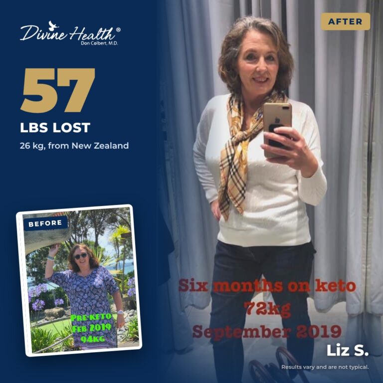 Liz S. before and after, 57 lbs (26 kg), New Zealand